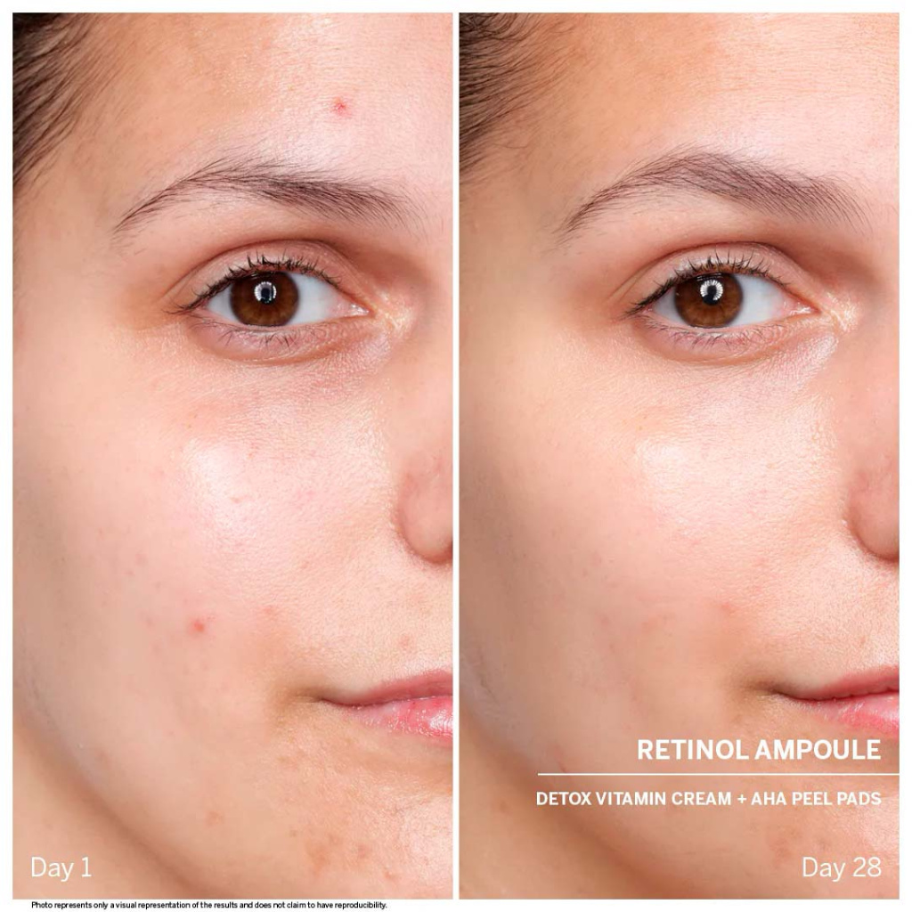 Результат применения Ампул с Ретинолом DOCTOR BABOR